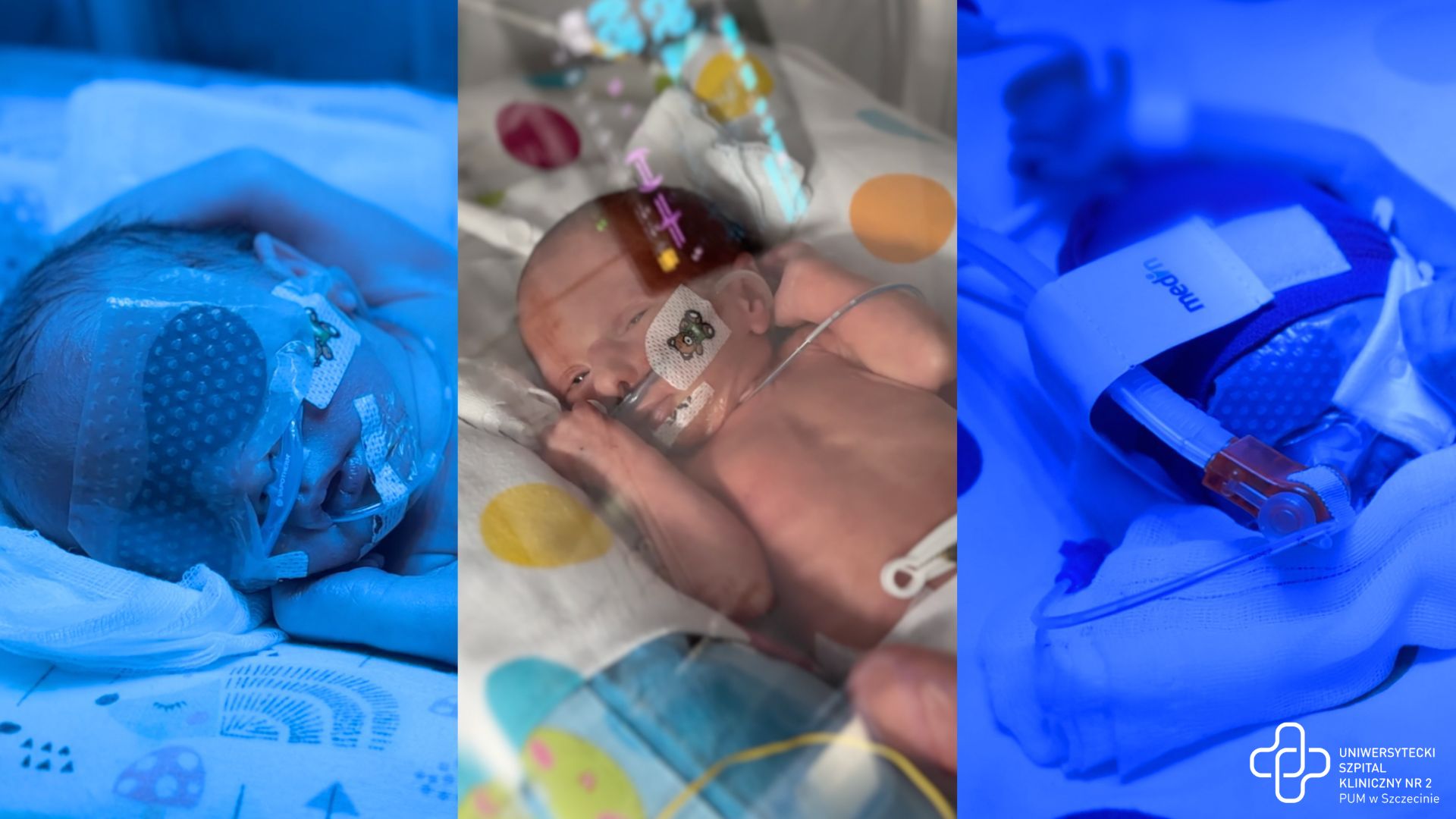 W szpitalu na Pomorzanach na świat przyszły trojaczki